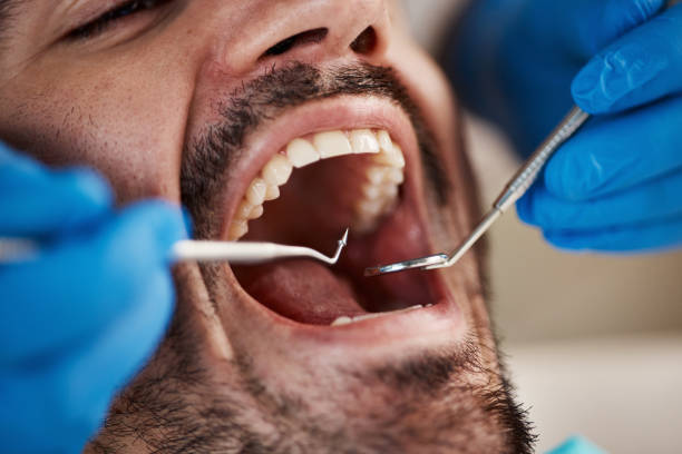 Best Emergency Dental Care for Broken or Chipped Teeth in Pearson, GA