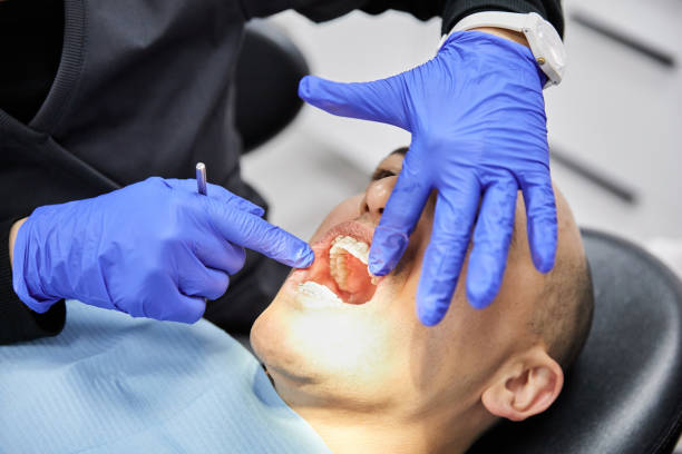 Best Emergency Treatment for Dental Infections or Abscesses in Pearson, GA